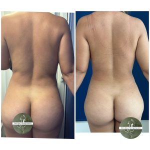 cirugía estética y reconstructiva en Medellín